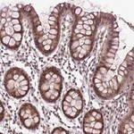 Merck Anti-ANKRD54 antibody produced in rabbit