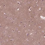 Merck Anti-RUNX1T1 antibody produced in rabbit