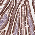 Merck Anti-NOXO1 antibody produced in rabbit