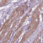 Merck Anti-MBLAC1 antibody produced in rabbit