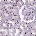 Merck Anti-POLE4 antibody produced in rabbit