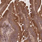 Merck Anti-DENND6A antibody produced in rabbit