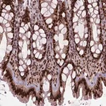 Merck Anti-SIRT6 antibody produced in rabbit