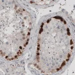 Merck Monoclonal Anti-SSX2 antibody produced in mouse