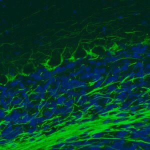 Merck Monoclonal Anti-NEFM antibody produced in mouse