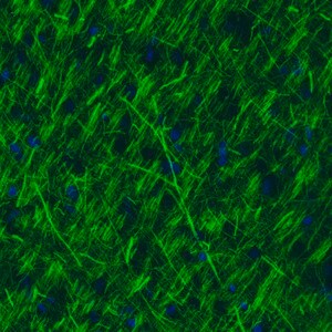 Merck Monoclonal Anti-NEFM antibody produced in mouse