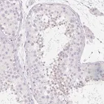 Merck Anti-SPACA5B antibody produced in rabbit