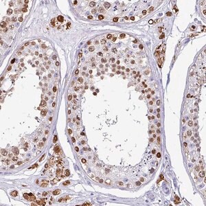 Merck Anti-VCY antibody produced in rabbit