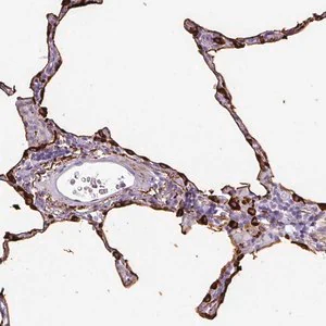 Merck Anti-SFTPA1 antibody produced in rabbit