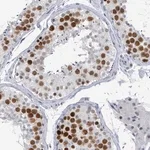 Merck Anti-CT45A1 antibody produced in rabbit