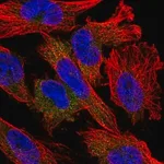 Merck Anti-NUDT10 antibody produced in rabbit