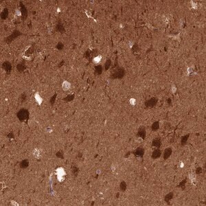 Merck Anti-PPP3R1 antibody produced in rabbit