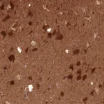 Merck Anti-PPP3R1 antibody produced in rabbit