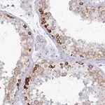 Merck Anti-DAZ1 antibody produced in rabbit