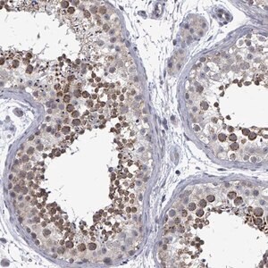 Merck Anti-PTPN20 antibody produced in rabbit