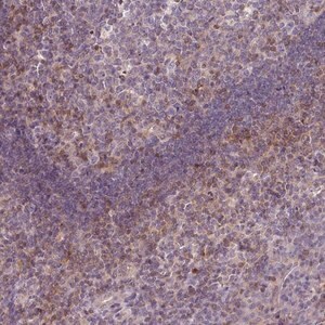 Merck Anti-STAT5A antibody produced in rabbit