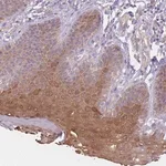 Merck Anti-SERPINB4 antibody produced in rabbit