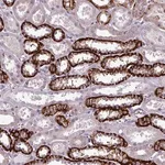 Merck Anti-PRAMEF7 antibody produced in rabbit