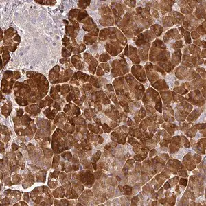 Merck Anti-MBD3L3 antibody produced in rabbit