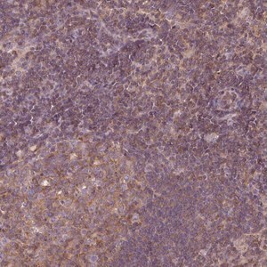 Merck Anti-STAT5A antibody produced in rabbit