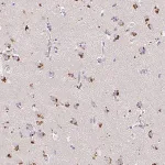 Merck Anti-MAP1LC3A antibody produced in rabbit