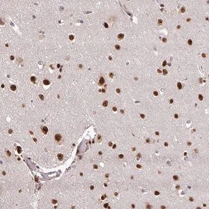 Merck Anti-U2AF1 antibody produced in rabbit