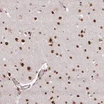 Merck Anti-U2AF1 antibody produced in rabbit