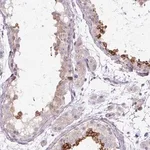 Merck Anti-TBC1D3L antibody produced in rabbit