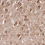 Merck Anti-CAMK2A antibody produced in rabbit