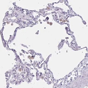 Merck Anti-XCL1 antibody produced in rabbit
