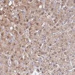 Merck Anti-ADH1A antibody produced in rabbit