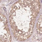 Merck Anti-TUBA1B antibody produced in rabbit