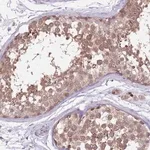 Merck Anti-TYW1 antibody produced in rabbit