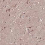 Merck Anti-TIGAR antibody produced in rabbit