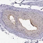 Merck Anti-MYO3B antibody produced in rabbit