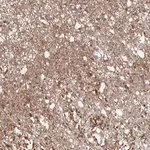 Merck Anti-CX3CR1 antibody produced in rabbit