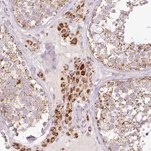 Merck Anti-NF1 antibody produced in rabbit