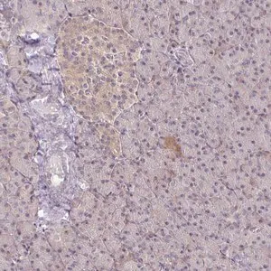 Merck Anti-PRKCB antibody produced in rabbit