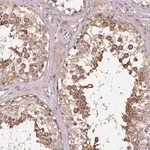 Merck Anti-KIAA1257 antibody produced in rabbit