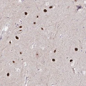 Merck Anti-PSMD3 antibody produced in rabbit