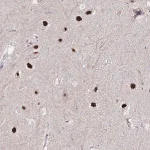 Merck Anti-PSMD3 antibody produced in rabbit