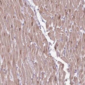 Merck Anti-AKAP6 antibody produced in rabbit