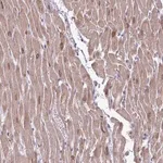 Merck Anti-AKAP6 antibody produced in rabbit