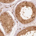 Merck Anti-EIF3B antibody produced in rabbit