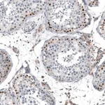 Merck Anti-TCF3 antibody produced in rabbit