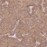Merck Anti-PLA2G4A antibody produced in rabbit