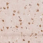 Merck Anti-RCN3 antibody produced in rabbit