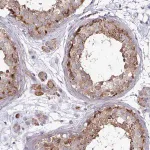 Merck Anti-SPRY1 antibody produced in rabbit