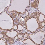 Merck Anti-SNX5 antibody produced in rabbit