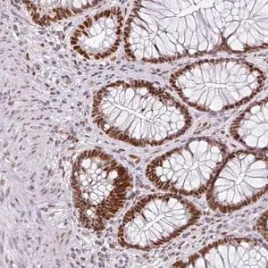 Merck Anti-RAD50 antibody produced in rabbit